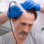 How-to-Prepare-for-MFU-Graft-Hair-Restoration-Treatment