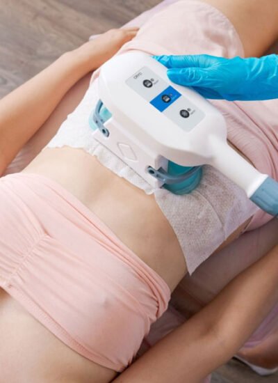 Preparing for Your Fat Freezing Procedure