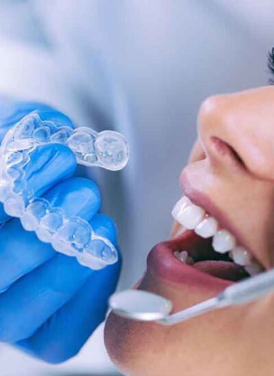 What to Expect During Invisalign Dentist Visits