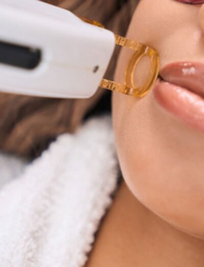 Can Laser Hair Removal Help Prevent Ingrown Hairs on the Female Face