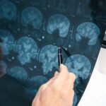 How Common Are Brain Injuries