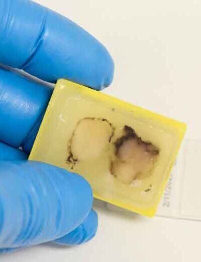 How FFPE Samples Improve Accuracy in Tissue-Based Testing