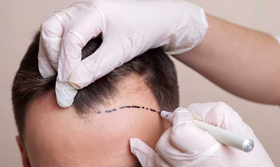 Tips-for-Maintaining-Results-After-No