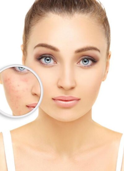 Tired of Dark Patches