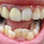 What If Your Teeth Could Talk