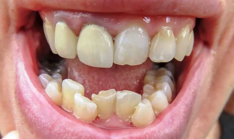 What If Your Teeth Could Talk