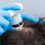 What-to-Expect-from-an-Alopecia-Specialist-in-Sydney