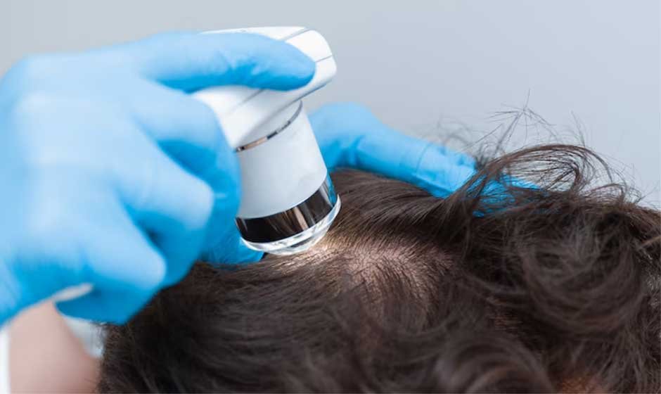 What-to-Expect-from-an-Alopecia-Specialist-in-Sydney