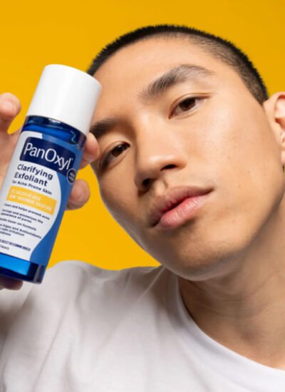 Why You Might Be Getting Acne Around Mouth Area & What to Do