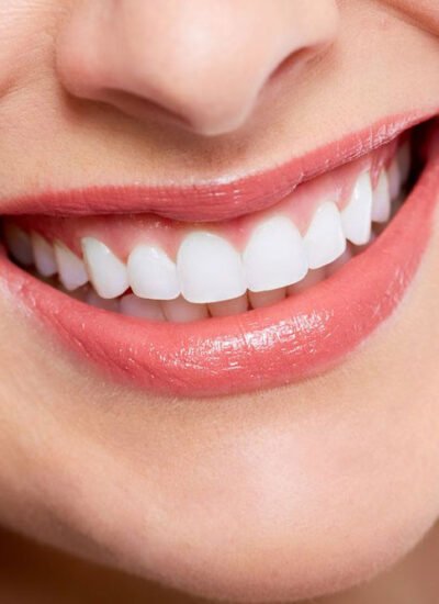 10 Benefits of Cosmetic Dentistry for You and Your Smile