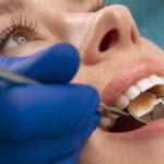 Dental Fillings