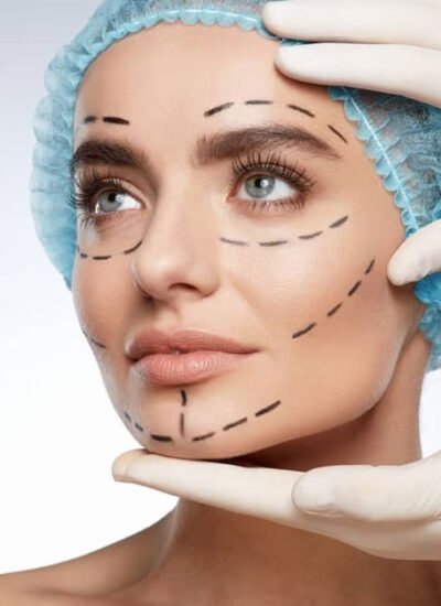 A 5-Step Framework for Preparing for Cosmetic Surgery