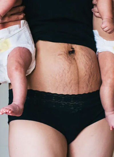 Feeling Disconnected from Your Body Post-Pregnancy