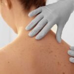 How a Board-Certified Dermatopathologist Can Transform Skin Health