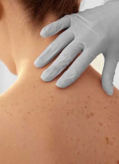 How a Board-Certified Dermatopathologist Can Transform Skin Health