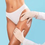 The Truth About Liposuction