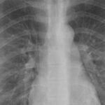 What Happens After an X-Ray Flags Something Suspicious