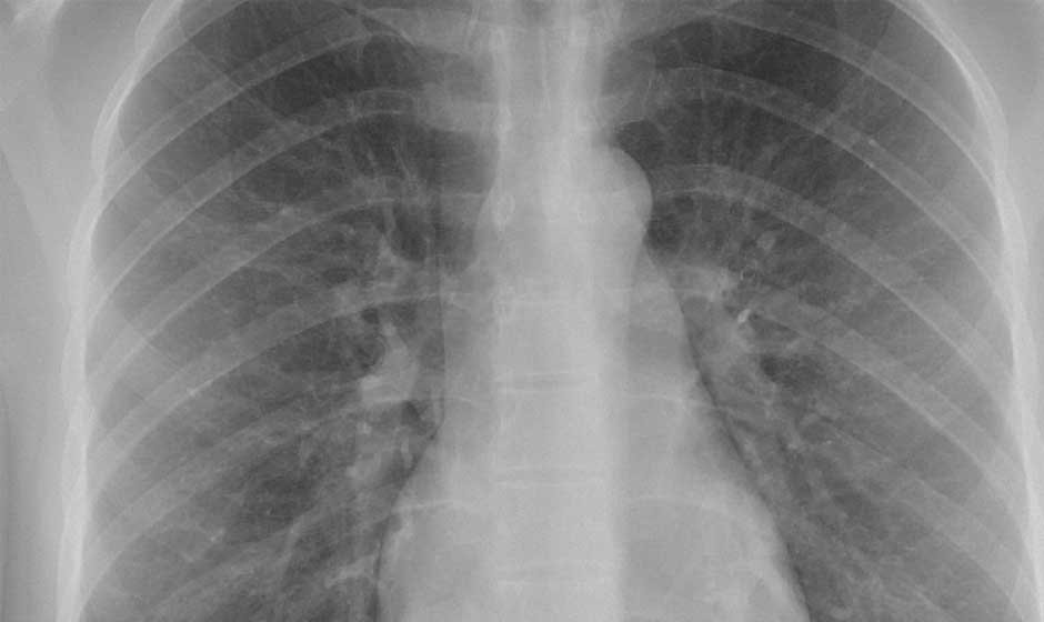 What Happens After an X-Ray Flags Something Suspicious