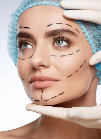 Thinking About Facial Plastic Surgery