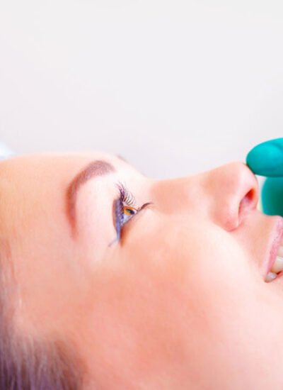 What to Expect From a Nose Job