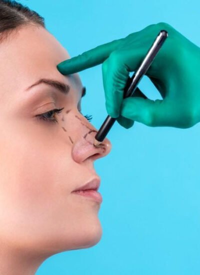 5 Common Myths About Nose Jobs Debunked