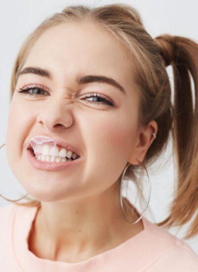 Adult Orthodontics for Crossbite