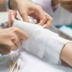 Essential-Qualities-to-Seek-in-Legal-Representation-for-Burn-Injuries