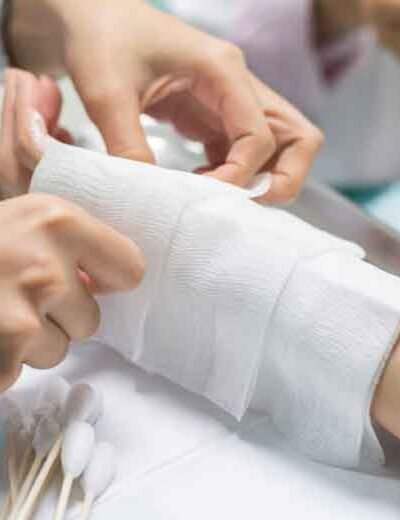 Essential-Qualities-to-Seek-in-Legal-Representation-for-Burn-Injuries