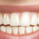 The Impact of Oral Health on Overall Wellbeing