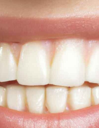 The Impact of Oral Health on Overall Wellbeing