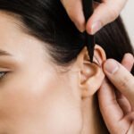 What Otoplasty Really Means for People Seeking Natural Facial Balance