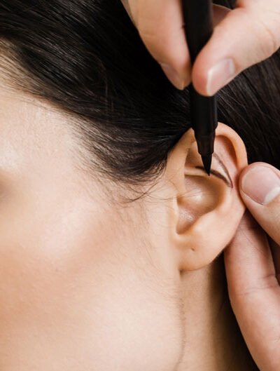 What Otoplasty Really Means for People Seeking Natural Facial Balance