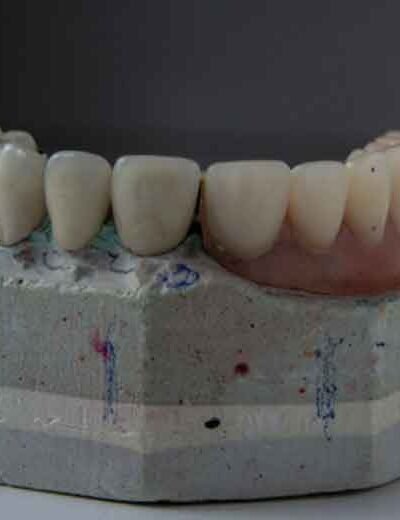 The-Role-of-Orthodontics-in-Achieving-Optimal-Oral-Health