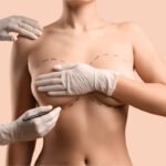 What to Know Before Getting Breast Augmentation Surgery