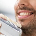 a-leading-london-cosmetic-dentist-reveals-7-secret-1