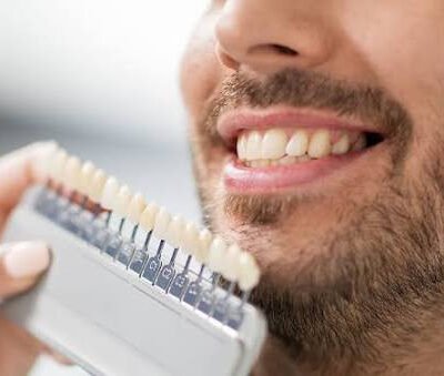 a-leading-london-cosmetic-dentist-reveals-7-secret-1